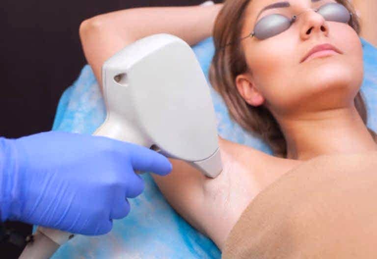 lazer epilasyon nedir
